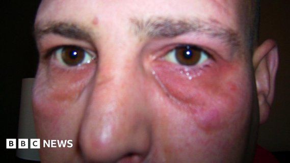 Image for twitter card